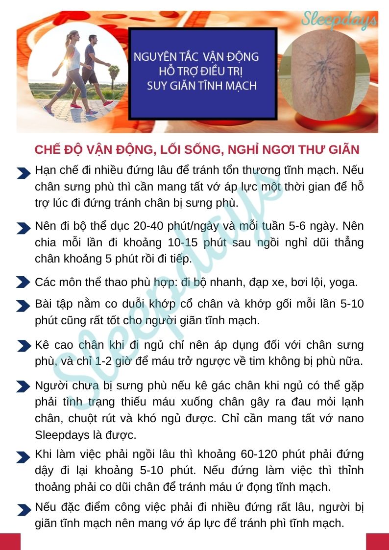 Vận động cho người giãn tĩnh mạch