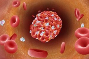 chống huyết khối là gì