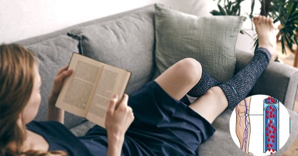 Cách trị giãn tĩnh mạch chân tại nhà 3 Cach_tri_gian_tinh_mach_chan_tai_nha