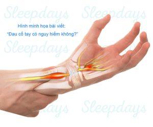 Đau cổ tay có nguy hiểm không?