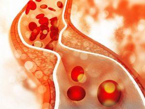 Lưu thông máu kém rất nguy hiểm. Bạn cần điều trị ngay