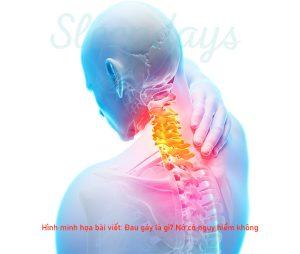Đau gáy (đau cổ) là gì? Nó có nguy hiểm không?