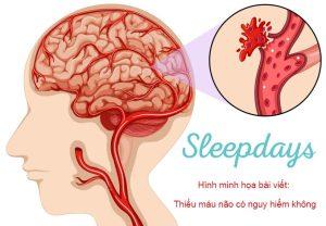 Thiếu máu não có nguy hiểm không?