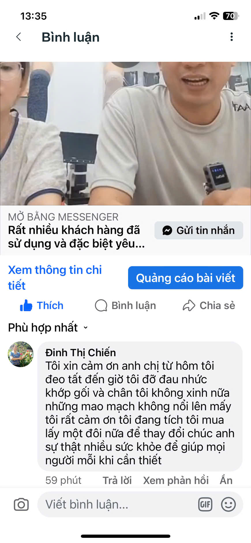 Tat-nano-nhat-ban-co-tot-khong-do-nhuc-khop